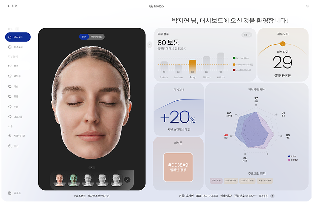 Luskin X 상세