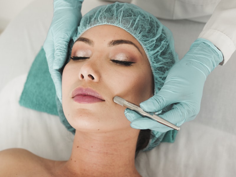 Chemical Peel